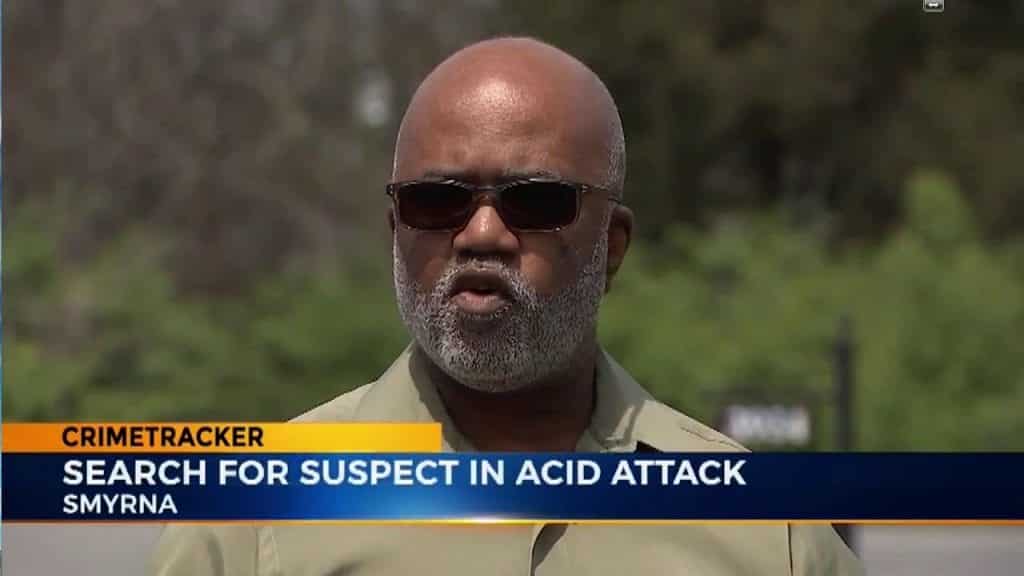 Trackstarz Social Media Director Attacked with Acid #cpstrong
